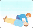 2、A(Airway):気道確保